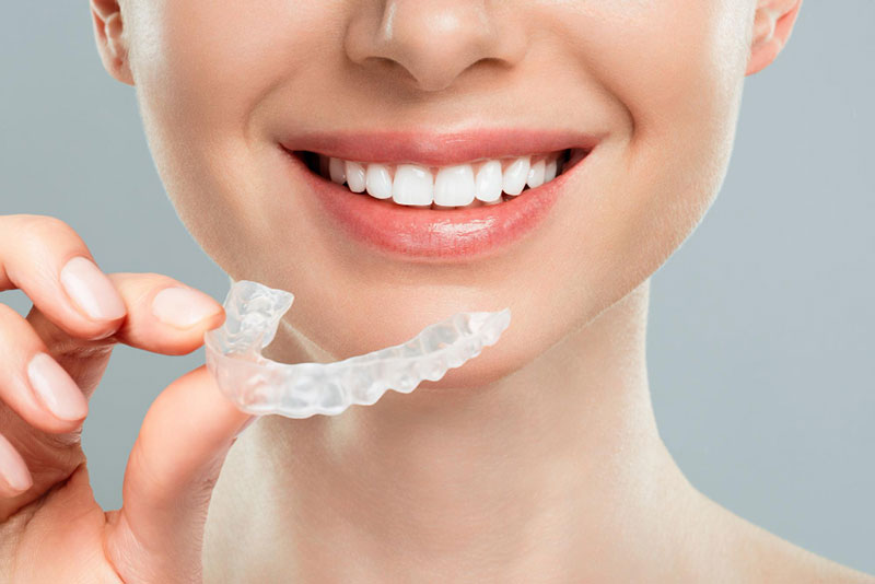15 Things You Need to Know Before Getting Invisalign to Straighten Your Teeth 